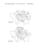 Method and Apparatus for Passing a Suture diagram and image