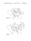 Method and Apparatus for Passing a Suture diagram and image