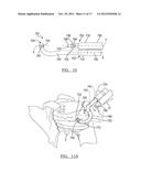 Method and Apparatus for Passing a Suture diagram and image