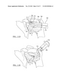 Method and Apparatus for Passing a Suture diagram and image