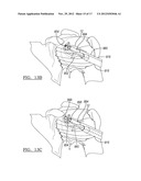 Method and Apparatus for Passing a Suture diagram and image