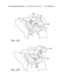 Method and Apparatus for Passing a Suture diagram and image