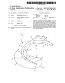 TRANSAPICAL VALVE REPLACEMENT diagram and image