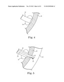 TRANSAPICAL VALVE REPLACEMENT diagram and image