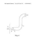 TRANSAPICAL VALVE REPLACEMENT diagram and image