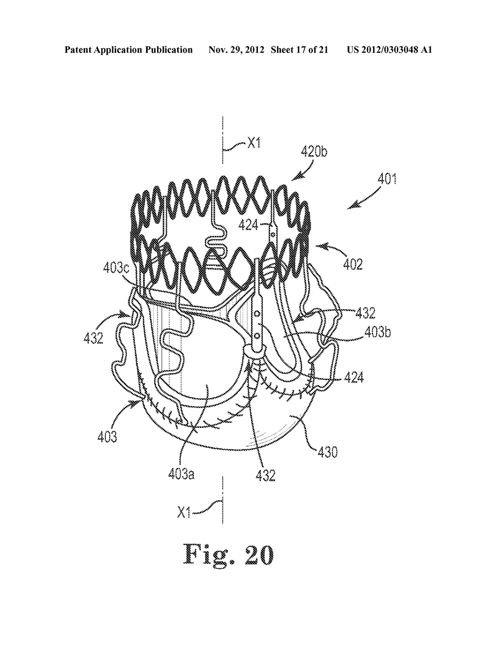 TRANSAPICAL VALVE REPLACEMENT - diagram, schematic, and image 18