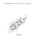 TRANSAPICAL VALVE REPLACEMENT diagram and image