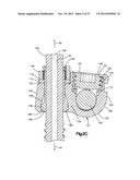 MINIMALLY INVASIVE SPINAL FIXATION SYSTEM INCLUDING VERTEBRAL ALIGNMENT     FEATURES diagram and image