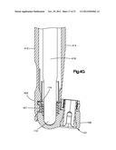 MINIMALLY INVASIVE SPINAL FIXATION SYSTEM INCLUDING VERTEBRAL ALIGNMENT     FEATURES diagram and image