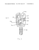 Bone Screw Assembly diagram and image