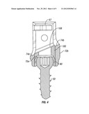 Bone Screw Assembly diagram and image