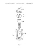 Bone Screw Assembly diagram and image