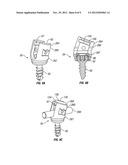 Bone Screw Assembly diagram and image