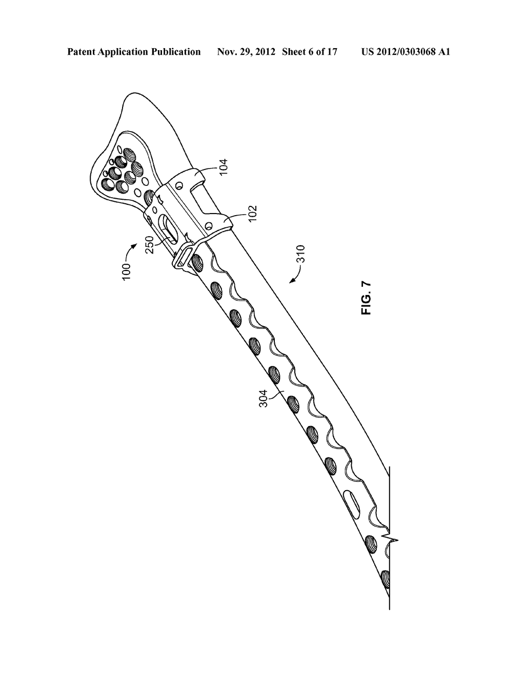 Bone Plate Positioning Scaffold - diagram, schematic, and image 07