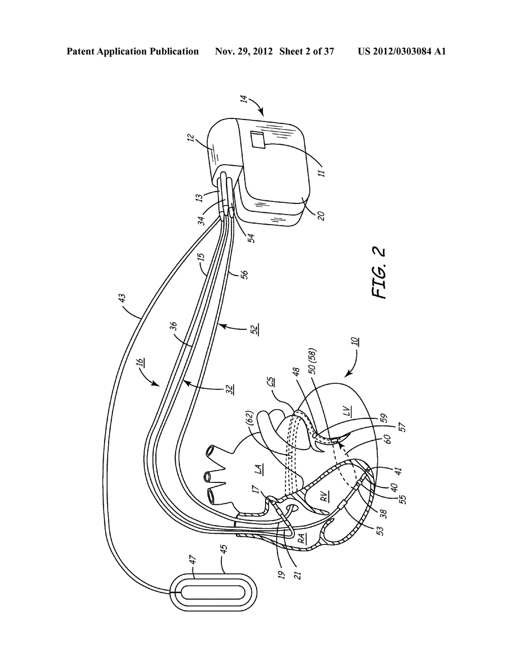 SECURE AND EFFICACIOUS THERAPY DELIVERY FOR A PACING ENGINE - diagram, schematic, and image 03