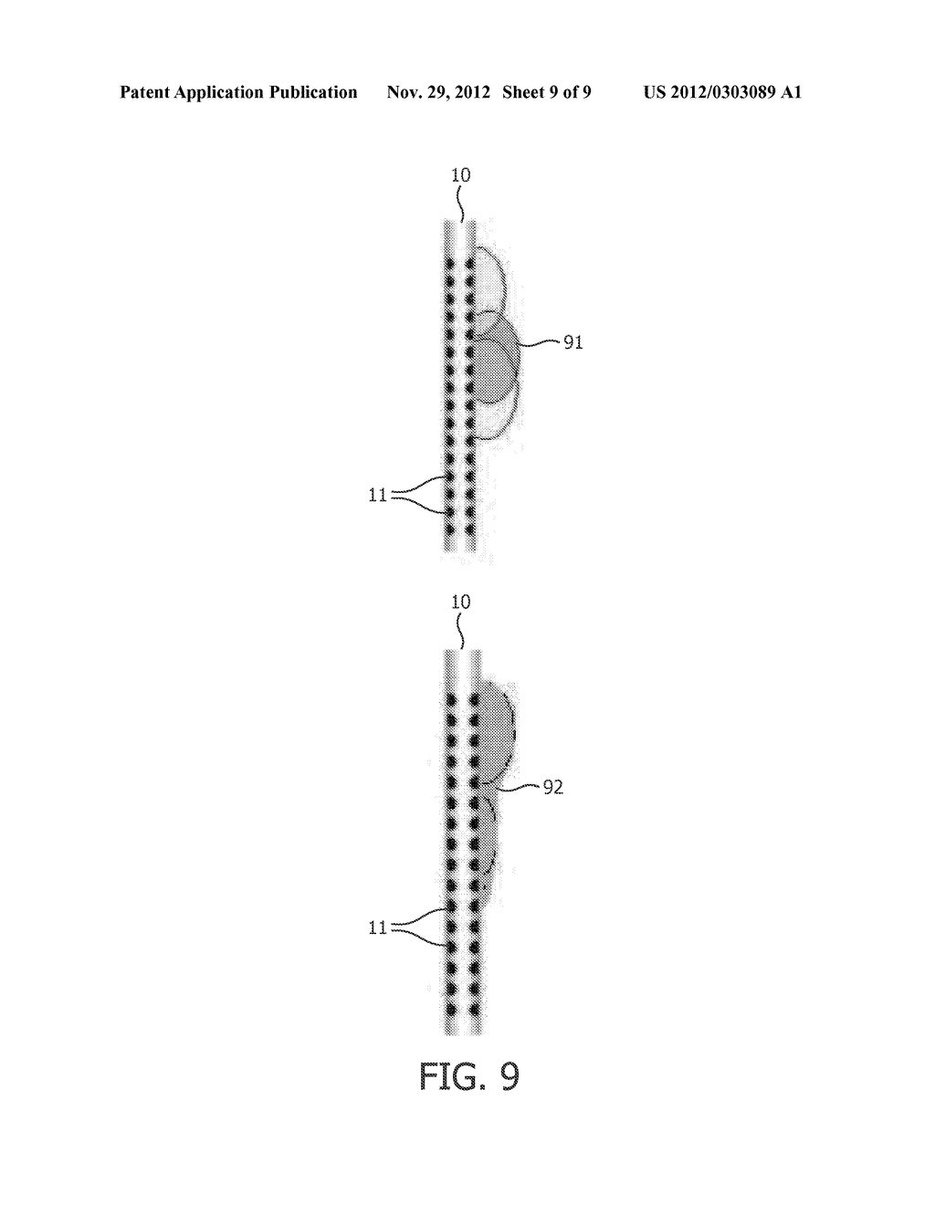 Method and System for Determining Settings for Deep Brain Stimulation - diagram, schematic, and image 10