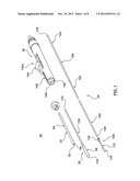 Attachment Mechanism for Stent Release diagram and image