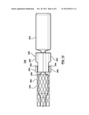 Attachment Mechanism for Stent Release diagram and image