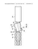 Attachment Mechanism for Stent Release diagram and image