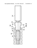 Attachment Mechanism for Stent Release diagram and image