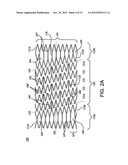 STENT diagram and image