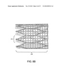 STENT diagram and image