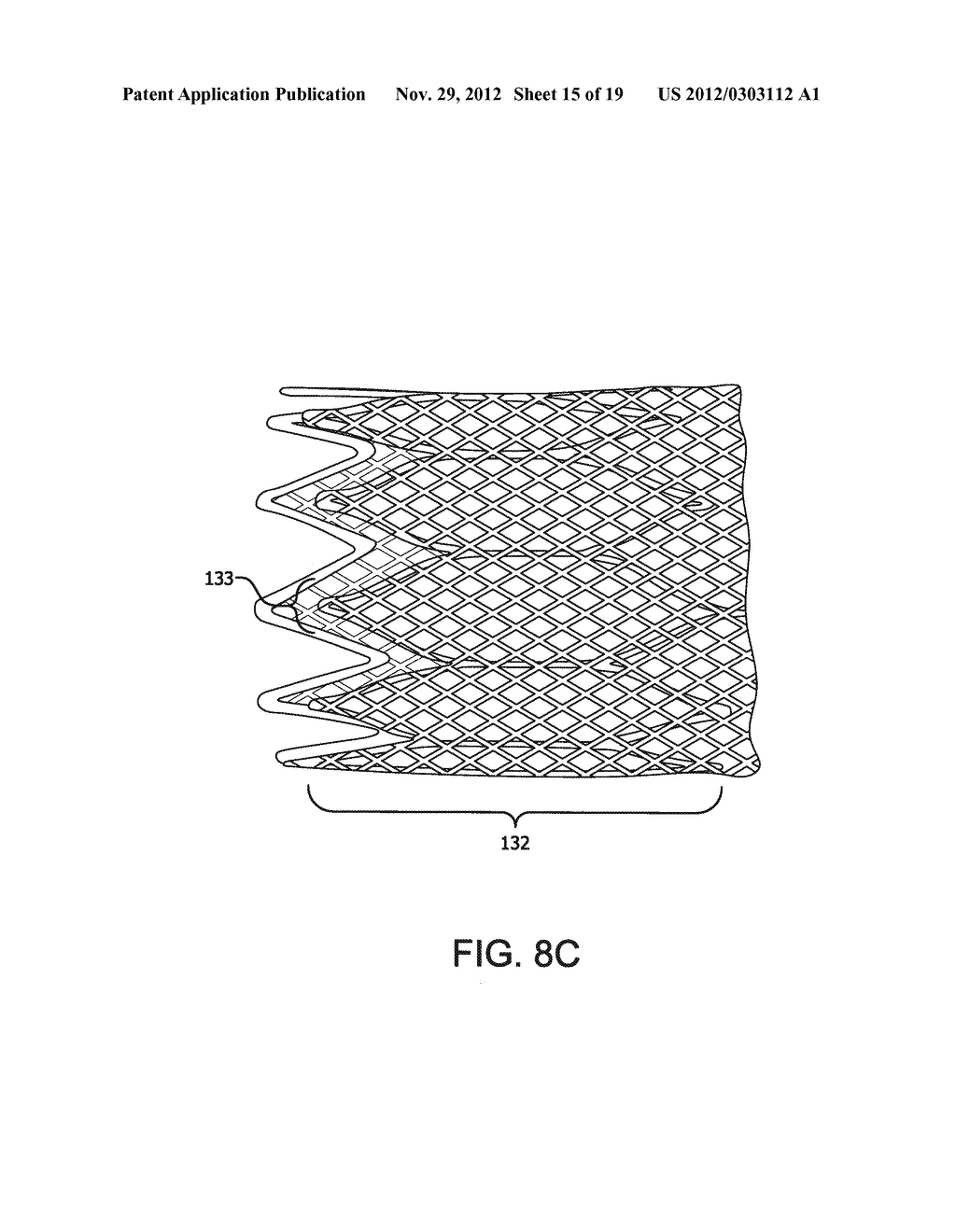 STENT - diagram, schematic, and image 16