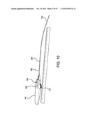 STENT diagram and image