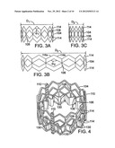 IMPLANTABLE PROSTHETIC VALVE ASSEMBLY AND METHOD FOR MAKING THE SAME diagram and image