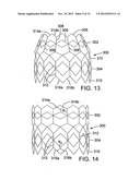 IMPLANTABLE PROSTHETIC VALVE ASSEMBLY AND METHOD FOR MAKING THE SAME diagram and image