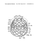 IMPLANTABLE PROSTHETIC VALVE ASSEMBLY AND METHOD FOR MAKING THE SAME diagram and image