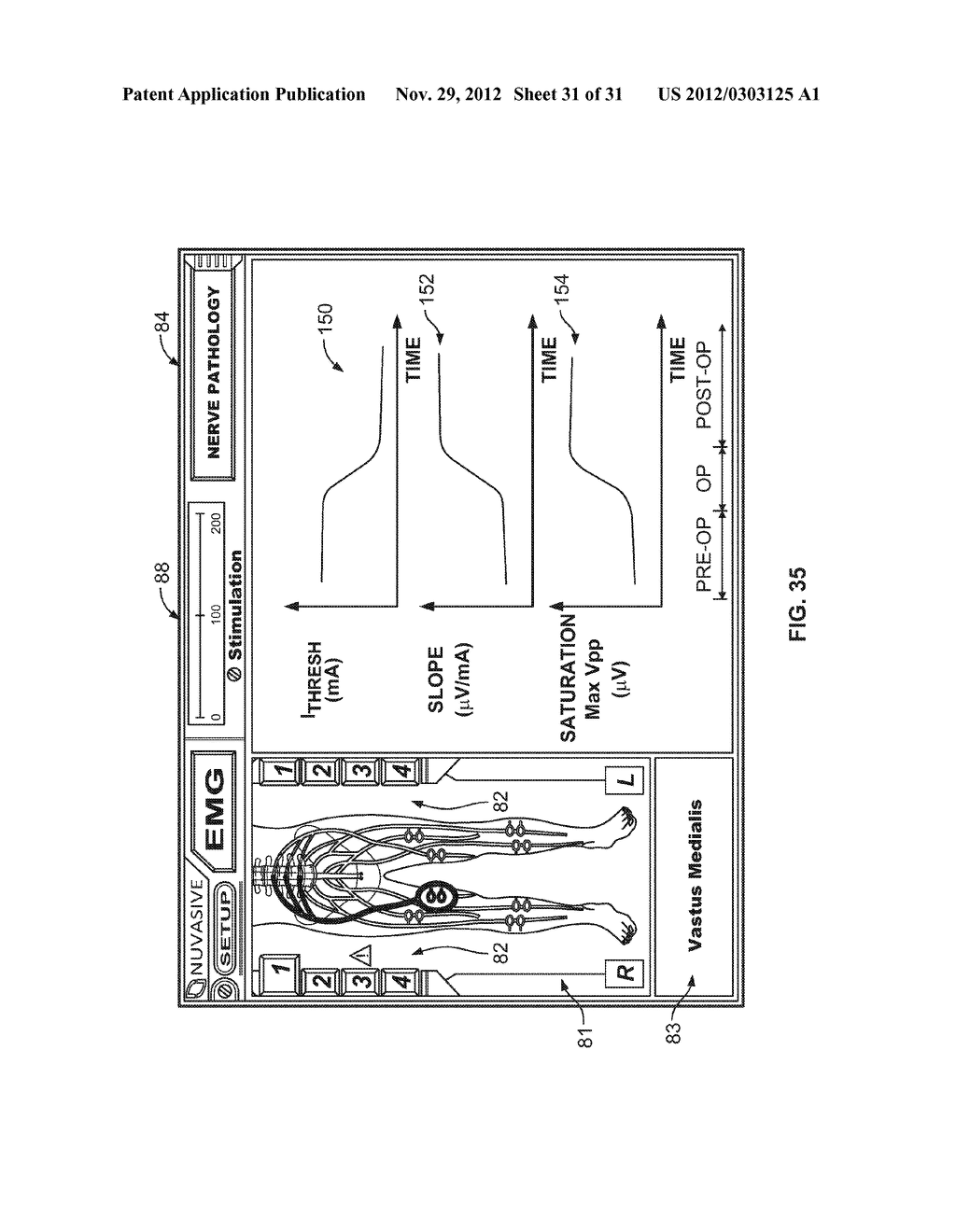 System And Methods For Performing Surgical Procedures and Assessments - diagram, schematic, and image 32