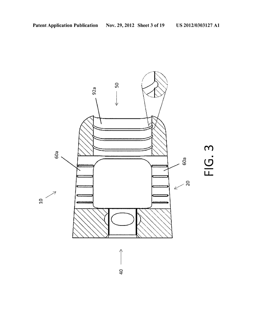 IMPLANTS HAVING INTERNAL FEATURES FOR GRAFT RETENTION AND LOAD TRANSFER     BETWEEN IMPLANT AND VERTEBRAE - diagram, schematic, and image 04