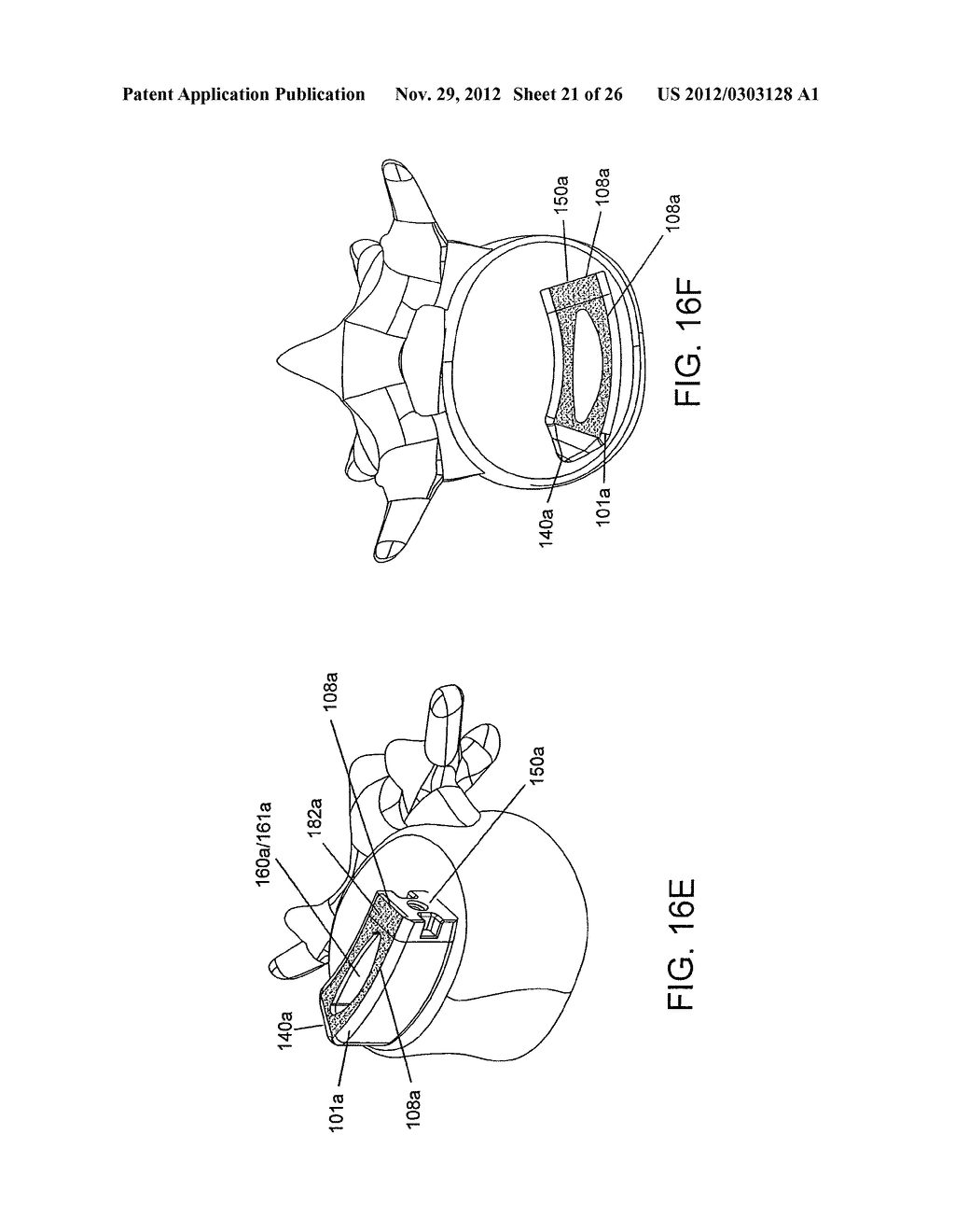 SPINAL IMPLANT AND INTEGRATION PLATE FOR OPTIMIZING VERTEBRAL ENDPLATE     CONTACT LOAD-BEARING EDGES - diagram, schematic, and image 22