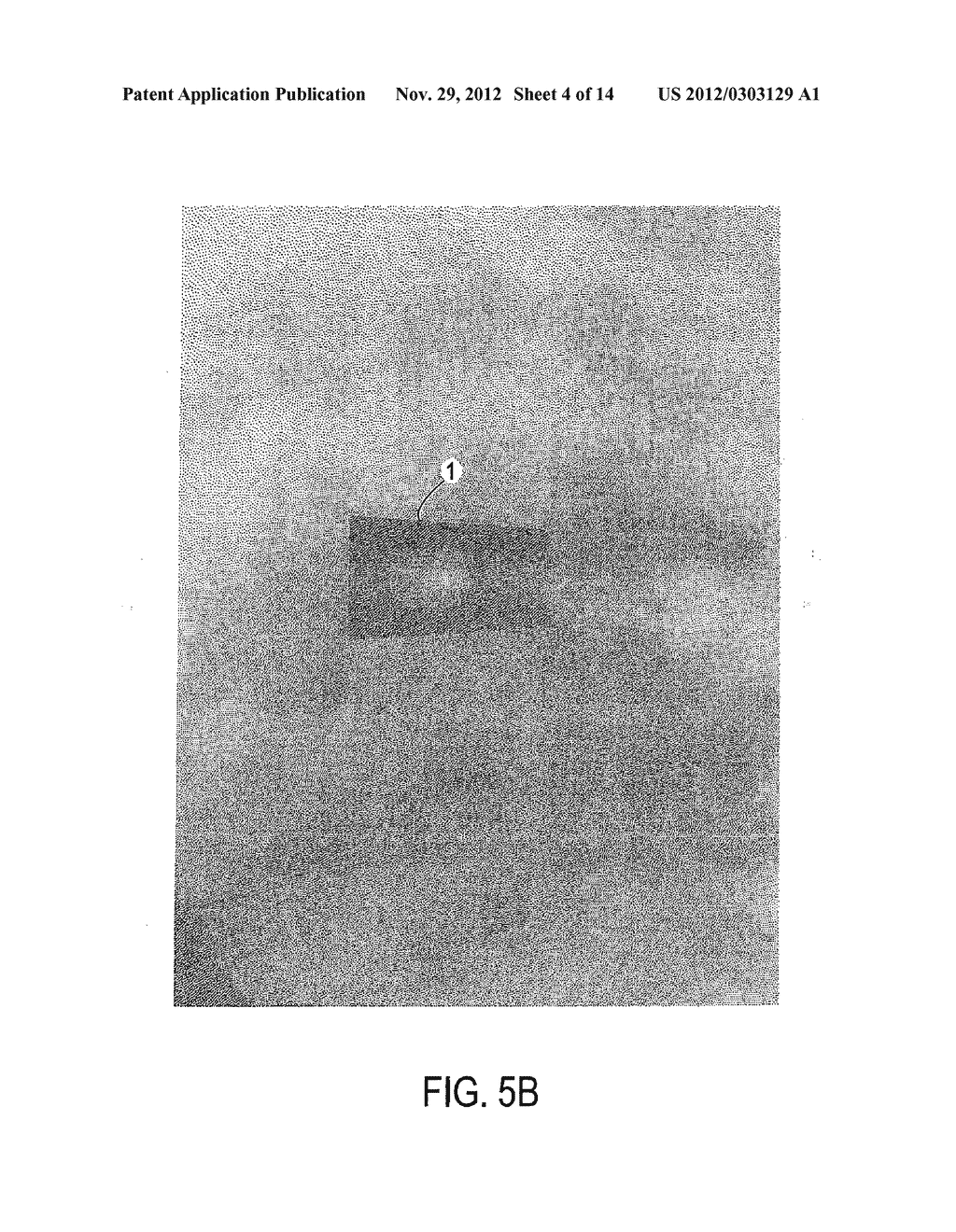 COMPOSITE INTERBODY SPINAL IMPLANT HAVING OPENINGS OF PREDETERMINED SIZE     AND SHAPE - diagram, schematic, and image 05