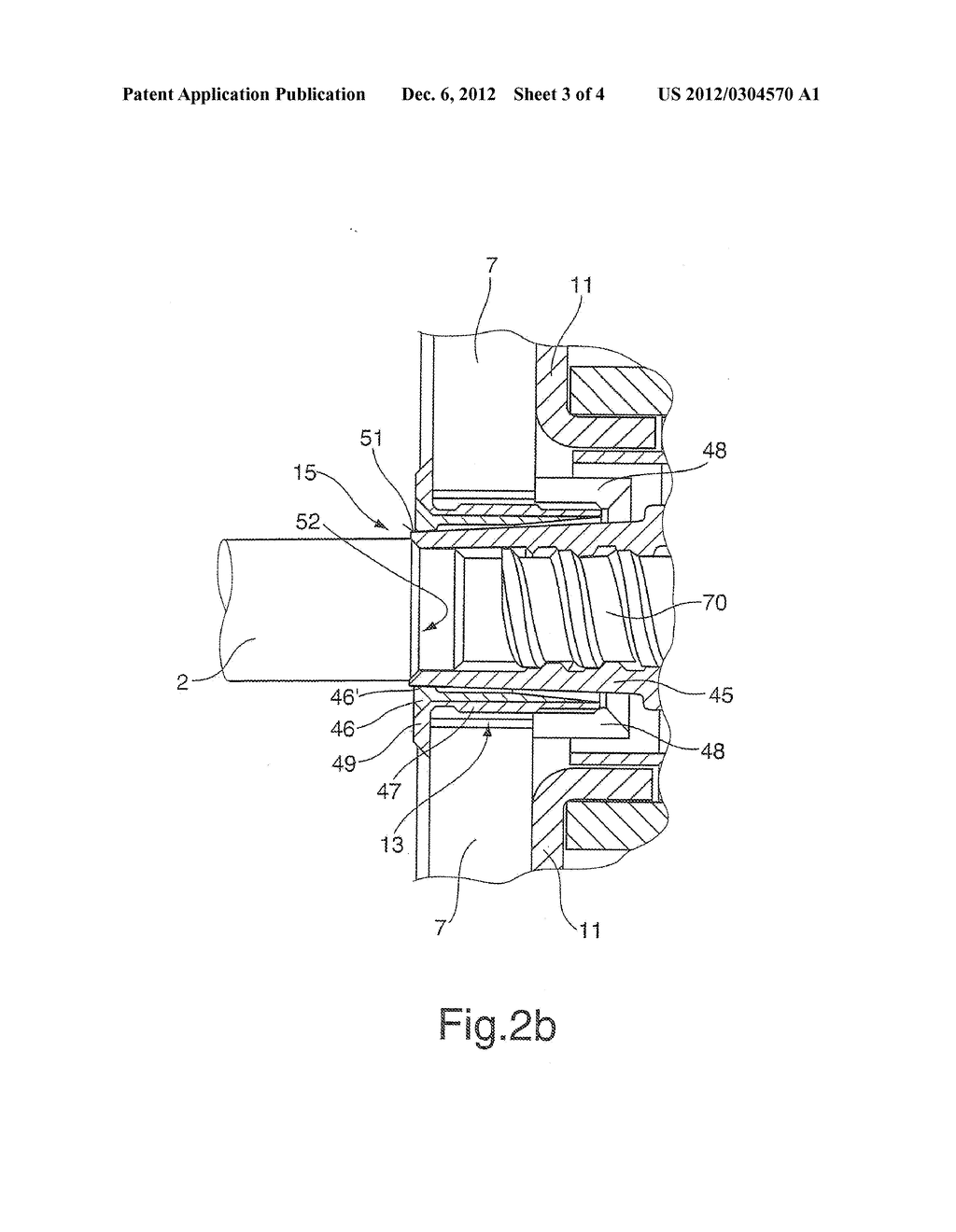 Anchor system of a concrete wall formwork - diagram, schematic, and image 04