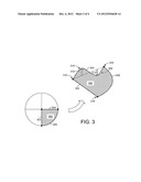 EXHAUST SYSTEM MIXING DEVICE diagram and image