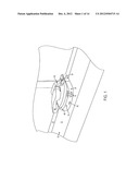 Status Monitoring System for a Fenestration Unit diagram and image