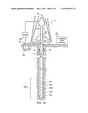 METHODS AND APPARATUS TO ESTIMATE FLUID COMPONENT VOLUMES diagram and image