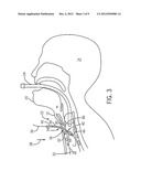 REVERSE TRACHEAL STOMA DILATION METHOD AND APPARATUS diagram and image