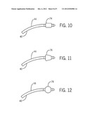 REVERSE TRACHEAL STOMA DILATION METHOD AND APPARATUS diagram and image