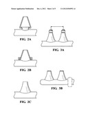 Breathing treatment system and method diagram and image