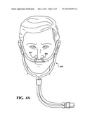 Breathing treatment system and method diagram and image