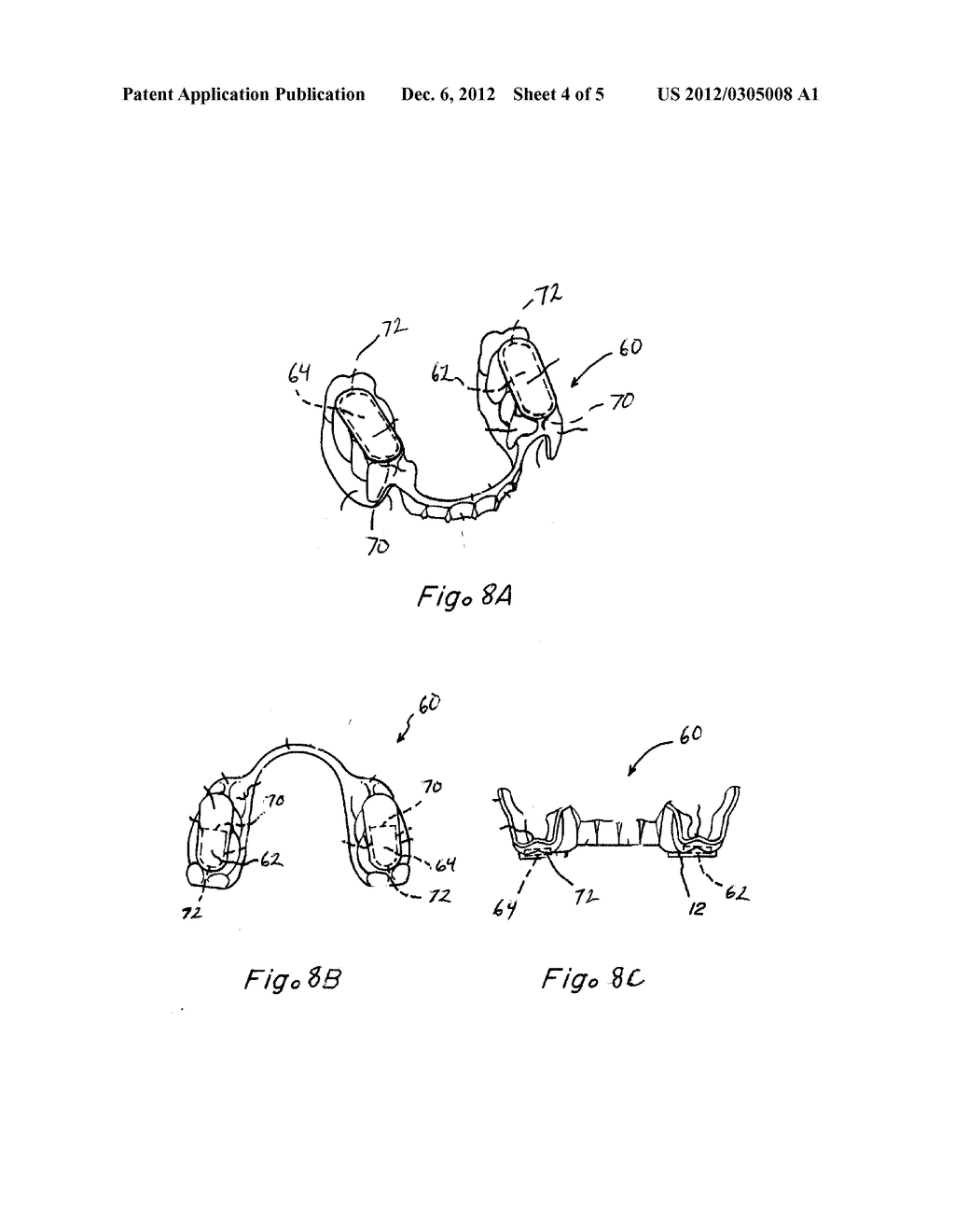 METHODS AND APPARATUS FOR REDUCTION OF LACTATE - diagram, schematic, and image 05