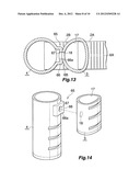 CONDENSER diagram and image