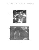 IMPLANTABLE MATERIALS HAVING ENGINEERED SURFACES AND METHOD OF MAKING SAME diagram and image