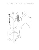 ANNULAR AIRBORNE VEHICLE diagram and image