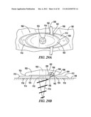 LEASH ANCHOR AND BOARD INCORPORATING THE SAME diagram and image