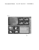 CHEMICAL LIQUID INJECTOR diagram and image