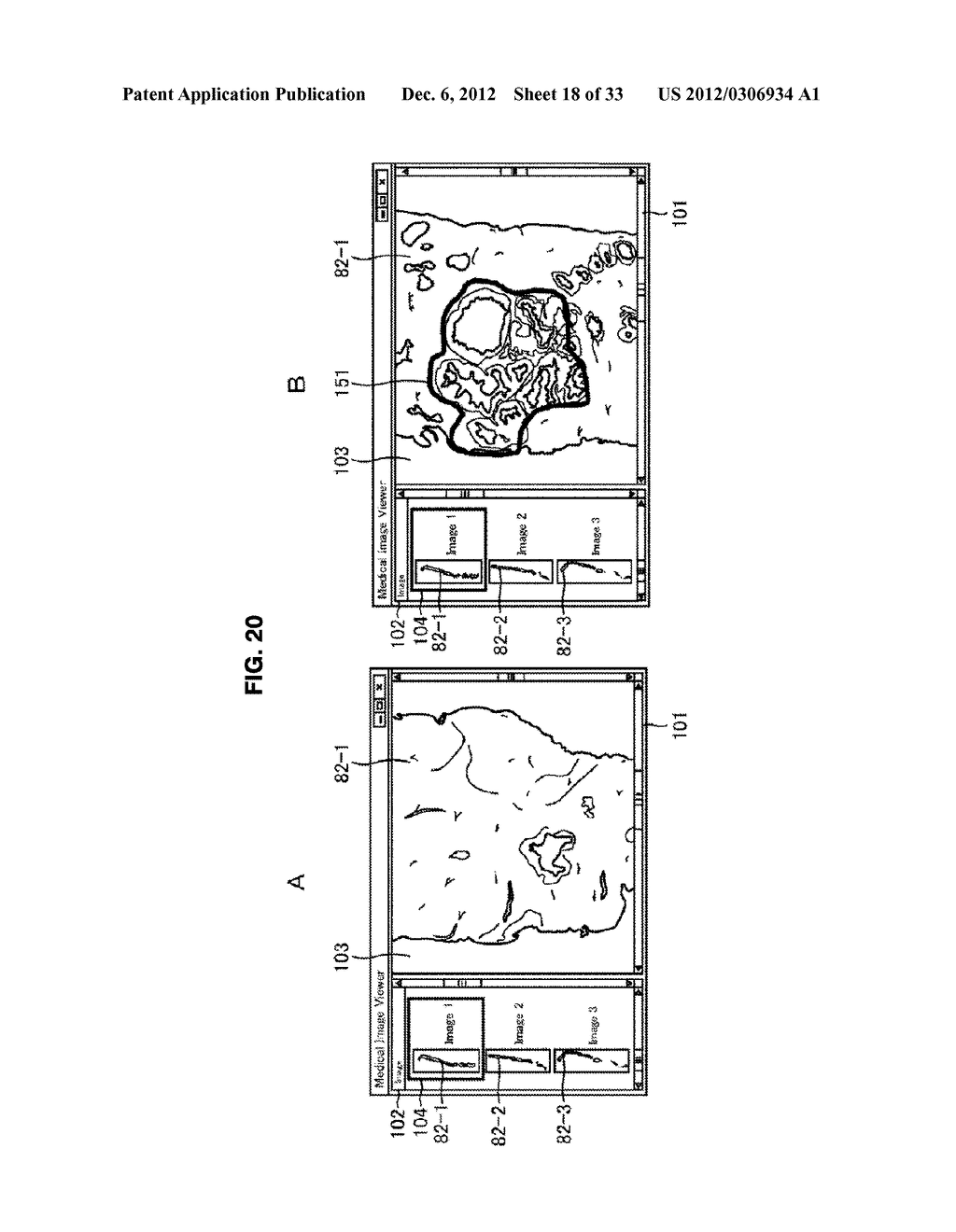 IMAGE PROCESSING DEVICE, IMAGE PROCESSING METHOD, RECORDING MEDIUM, AND     PROGRAM - diagram, schematic, and image 19